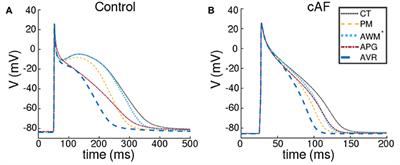 Electrophysiological Characterization of Human Atria: The Understated Role of Temperature